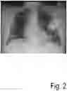 Fig. 03 - SYSTEM AND METHOD FOR IMAGE DECOMPOSITION OF A PROJECTION IMAGE