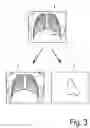 Fig. 04 - SYSTEM AND METHOD FOR IMAGE DECOMPOSITION OF A PROJECTION IMAGE