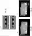 Fig. 05 - AUTOMATED AND ROBUST METHOD FOR RECORDING NM-RESOLUTION 3D IMAGE DATA FROM SERIAL ULTRA-SECTIONS OF LIFE-SCIENCES SAMPLES WITH ELECTRON MICROSCOPES