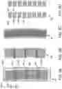 Fig. 17 - AUTOMATED AND ROBUST METHOD FOR RECORDING NM-RESOLUTION 3D IMAGE DATA FROM SERIAL ULTRA-SECTIONS OF LIFE-SCIENCES SAMPLES WITH ELECTRON MICROSCOPES