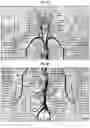 Fig. 07 - SYSTEM AND METHOD FOR MEDICAL CODING OF VASCULAR INTERVENTIONAL RADIOLOGY PROCEDURES