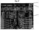 Fig. 08 - SYSTEM AND METHOD FOR MEDICAL CODING OF VASCULAR INTERVENTIONAL RADIOLOGY PROCEDURES