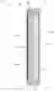 Fig. 01 - Dual electrolyte electrochemical cells, systems, and methods of manufacturing the same