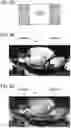 Fig. 11 - IMAGING DEVICE, IMAGING SYSTEM, AND IMAGING METHOD