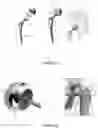 Fig. 02 - Prosthesis for hip replacement with polyethylene head and anti-rotational intra-prosthetic assembly
