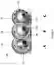 Fig. 03 - Prosthesis for hip replacement with polyethylene head and anti-rotational intra-prosthetic assembly