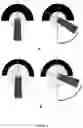 Fig. 05 - Prosthesis for hip replacement with polyethylene head and anti-rotational intra-prosthetic assembly