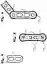 Fig. 04 - Modular Wall Elements, Systems, and Methods