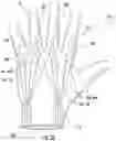 Fig. 04 - Wearable device capable of inducing electro-muscular incapacitation