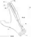 Fig. 05 - Wearable device capable of inducing electro-muscular incapacitation