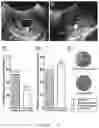 Fig. 03 - Method for preparing non-human primate somatic cell cloned animal