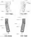 Fig. 197 - Headset having right- and left-ear sound output units with through-holes formed therein