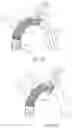 Fig. 06 - Accessory device to provide neuroprotection during interventional procedures