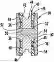 Fig. 01 - Elevator sheave liner