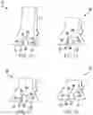 Fig. 08 - Fuel injector with divided flowpath nozzle