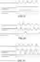 Fig. 28 - Implantable micro-biosensor and method for manufacturing the same