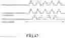 Fig. 31 - Implantable micro-biosensor and method for manufacturing the same