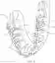 Fig. 03 - Systems and method for additive manufacturing of dental devices using photopolymer resins