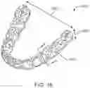 Fig. 13 - Systems and method for additive manufacturing of dental devices using photopolymer resins