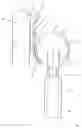 Fig. 02 - Magnetic artificial joint
