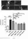 Fig. 04 - OPHTHALMIC PHARMACEUTICAL COMPOSITION, PREPARATION METHOD THEREFOR AND APPLICATION THEREOF