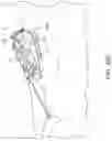 Fig. 22 - Fluidic Drivers, Devices, Methods, and Systems for Catheters and Other Uses