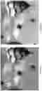 Fig. 08 - Vision correction system and method, light field display and light field shaping layer and alignment therefor