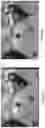 Fig. 09 - Vision correction system and method, light field display and light field shaping layer and alignment therefor