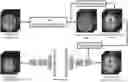 Fig. 01 - Device for spatial normalization of medical image using deep learning and method therefor