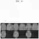 Fig. 09 - Device for spatial normalization of medical image using deep learning and method therefor