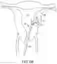Fig. 07 - Methods and systems for controlled deployment of needles in tissue