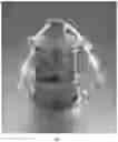 Fig. 02 - Closed-system manufacturing process for CAR-T cells