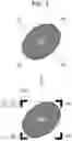 Fig. 04 - Medical image processing device, medical image processing method, and endoscope system
