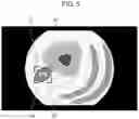 Fig. 06 - Medical image processing device, medical image processing method, and endoscope system