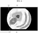 Fig. 07 - Medical image processing device, medical image processing method, and endoscope system