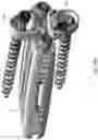 Fig. 41 - Dual-axis adjustable spinal systems and interbody fusion devices with fixation