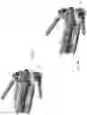 Fig. 45 - Dual-axis adjustable spinal systems and interbody fusion devices with fixation