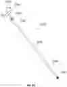 Fig. 22 - Shoulder implant impactor with stabilization features