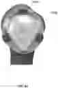 Fig. 30 - Shoulder implant impactor with stabilization features