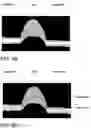 Fig. 07 - Method and arrangements for providing intensity peak position in image data from light triangulation in a three-dimensional imaging system