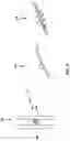 Fig. 06 - Feedthrough rejection for optomechanical devices using elements