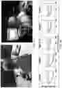 Fig. 06 - PORTABLE BRAIN ACTIVITY SENSING PLATFORM FOR ASSESSMENT OF VISUAL FIELD DEFICITS