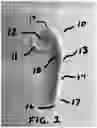 Fig. 02 - HAND STABILIZING DEVICES