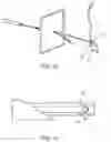 Fig. 07 - Instrument to manipulate and pass suture