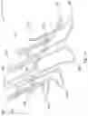 Fig. 02 - Sutureless graft anastomotic quick connect system