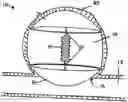 Fig. 01 - Intra-aneurysm devices