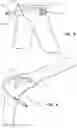 Fig. 07 - Inflatable radial artery compression device