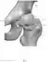Fig. 02 - Surgical guide system
