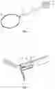 Fig. 03 - Tissue specimen retrieval devices with integrated bag cut-off mechanism