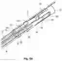Fig. 04 - Tissue specimen retrieval devices with integrated bag cut-off mechanism